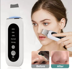 Ultrasonic Skin Scrubber