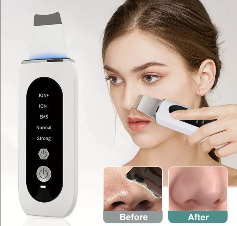 Ultrasonic Skin Scrubber